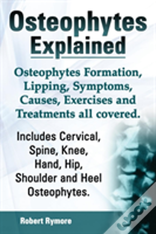 Osteophytes Explained. Osteophytes Formation, Lipping, Symptoms, Causes, Exercises And Treatments All Covered. Includes Cervical, Spine, Knee, Hand, H