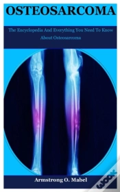 Capa do artigo Osteosarcoma