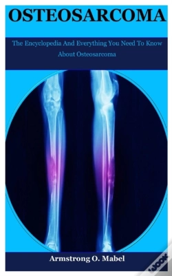 Capa do artigo Osteosarcoma
