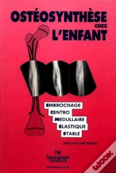 Osteosynthese De L Enfant Par Embrochage Ce