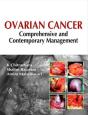 Ovarian Cancer Comprehensive Contempora - Preview