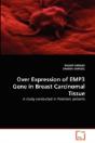 Over Expression Of Emp3 Gene In Breast Carcinomal Tissue - Preview