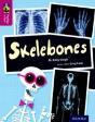 Oxford Reading Tree Treetops Infact: Level 10: Skelebones - Preview