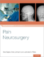 Pain Neurosurgery - Preview