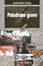 Paludisme Grave