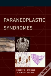 Capa do artigo Paraneoplastic Syndromes