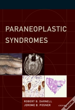 Capa do artigo Paraneoplastic Syndromes