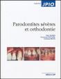 Parodontités Sévères Et Orthodontie - Preview