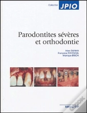 Parodontités Sévères Et Orthodontie