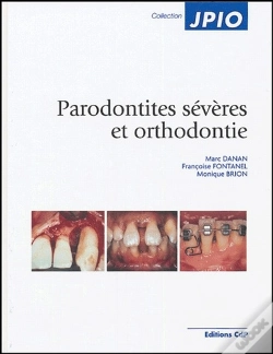 Capa do artigo Parodontités Sévères Et Orthodontie