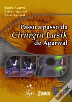 Passo a Passo da Cirurgia Lasik