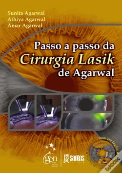 Capa do artigo Passo a Passo da Cirurgia Lasik