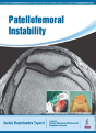 Patellofemoral Instability - Preview