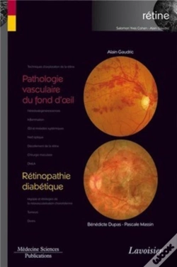 Capa do artigo Pathologie Vasculaire Du Fond D'Oeil ; Rétinopathie Diabétique