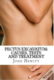 Capa do artigo Pectus Excavatum: Causes, Tests And Treatment