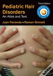 Capa do artigo Pediatric Hair Disorders