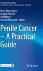 Penile Cancer Â€“ A Practical Guide - Preview