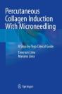 Percutaneous Collagen Induction With Microneedling - Preview