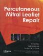 Percutaneous Mitral Leaflet Repair - Preview