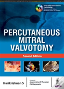 Capa do artigo Percutaneous Mitral Valvotomy