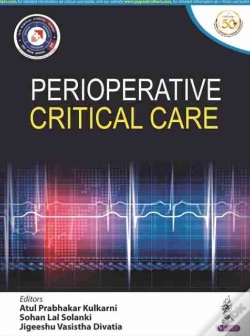 Capa do artigo Perioperative Critical Care