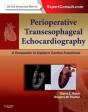 Perioperative Transesophageal Echocardiography - Preview