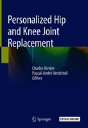 Personalized Hip And Knee Joint Replacement - Preview
