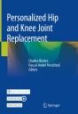Personalized Hip And Knee Joint Replacement - Preview