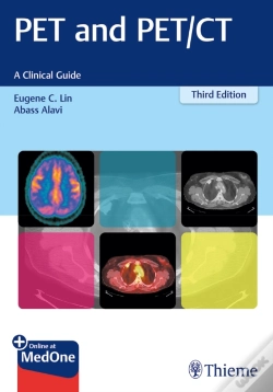 Capa do artigo Pet And Pet/Ct