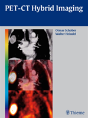 Pet-Ct Hybrid Imaging - Preview