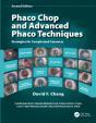 Phaco Chop And Advanced Phaco Techniques - Preview