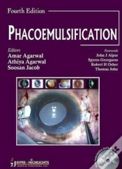 Capa do artigo Phacoemulsification Surgery