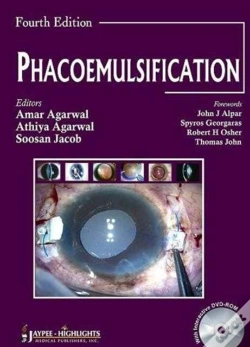 Capa do artigo Phacoemulsification Surgery
