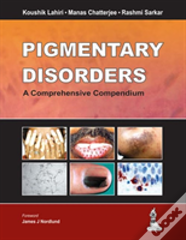 Pigmentary Disorders