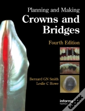 Capa do artigo Planning And Making Crowns And Bridges