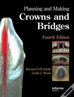 Capa do artigo Planning And Making Crowns And Bridges