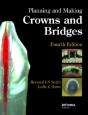 Planning And Making Crowns And Bridges - Preview