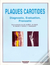 Plaques Carotides