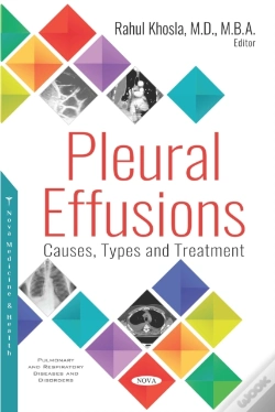 Capa do artigo Pleural Effusions: Causes, Types And Treatment