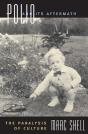 Polio And Its Aftermath - Preview