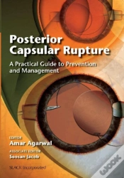 Capa do artigo Posterior Capsular Rupture