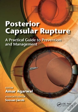 Capa do artigo Posterior Capsular Rupture
