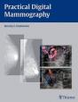 Practical Digital Mammography - Preview