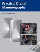 Practical Digital Mammography