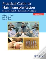 Practical Guide To Hair Transplantation