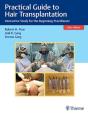 Practical Guide To Hair Transplantation - Preview