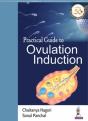 Practical Guide To Ovulation Induction - Preview