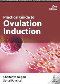 Capa do artigo Practical Guide To Ovulation Induction