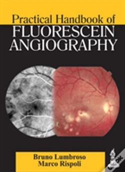 Capa do artigo Practical Handbook Of Fluorescein Angiography