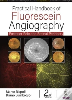 Capa do artigo Practical Handbook Of Fluorescein Angiography